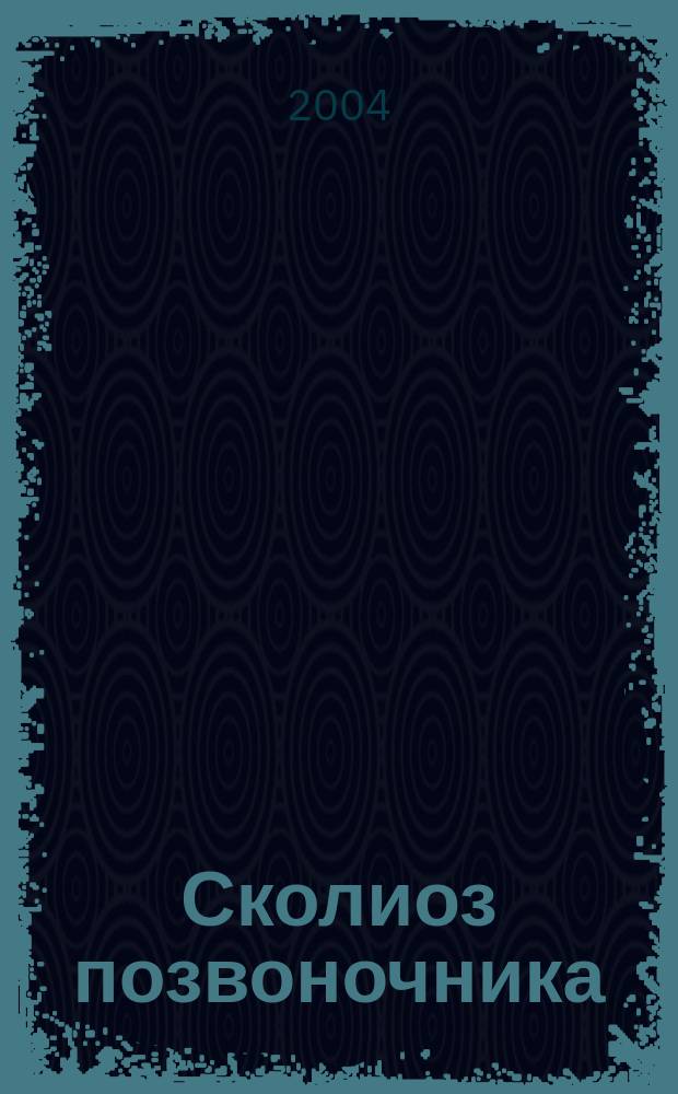 Сколиоз позвоночника : Лечение и профилактика