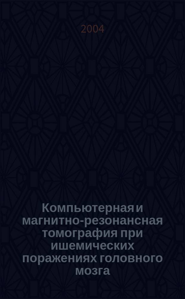 Компьютерная и магнитно-резонансная томография при ишемических поражениях головного мозга : Учеб. пособие