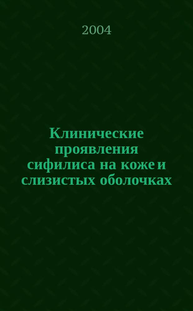 Клинические проявления сифилиса на коже и слизистых оболочках : пособие для врачей