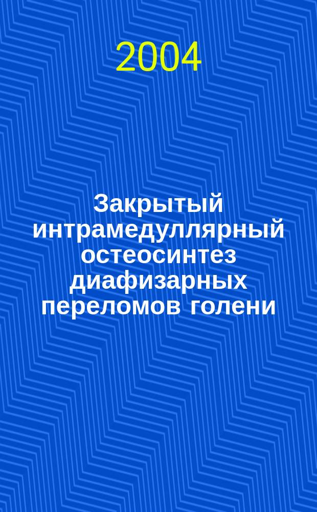 Закрытый интрамедуллярный остеосинтез диафизарных переломов голени