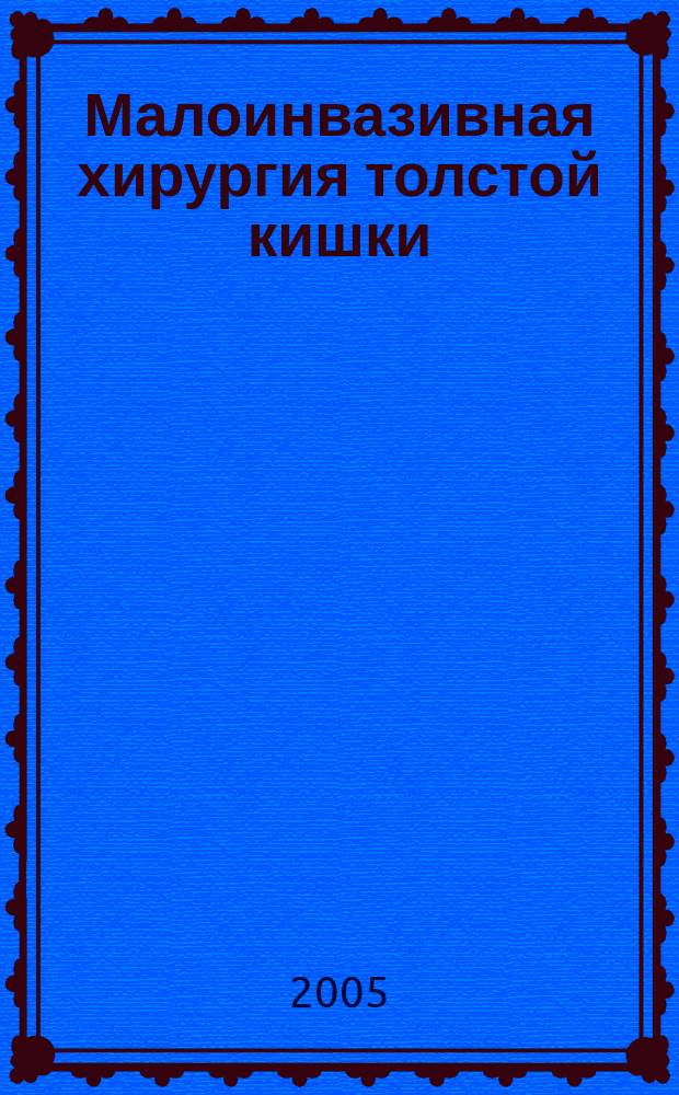 Малоинвазивная хирургия толстой кишки : руководство для врачей