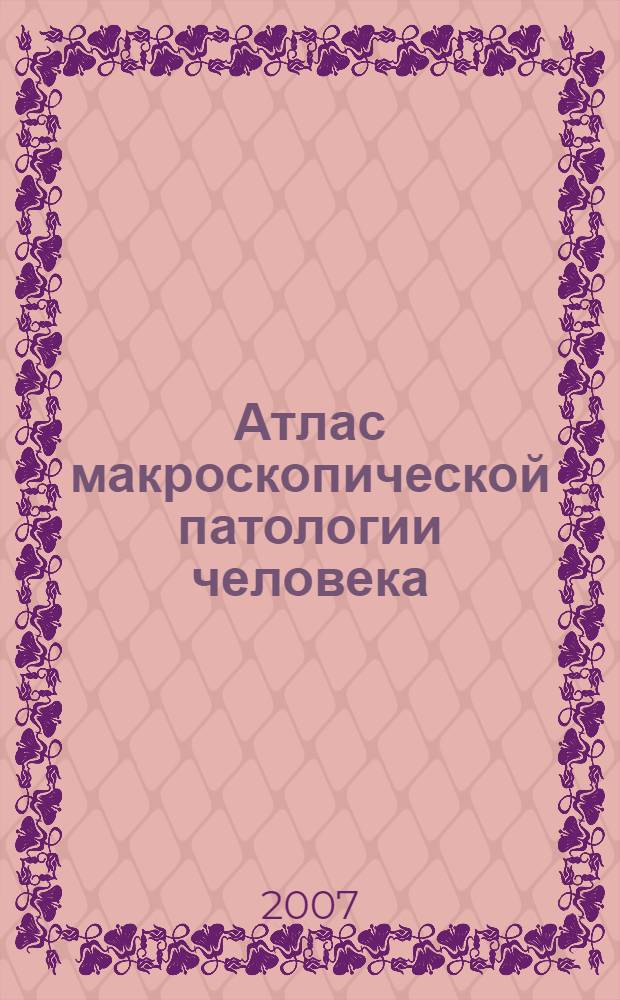 Атлас макроскопической патологии человека : учебное пособие для студентов медицинских вузов