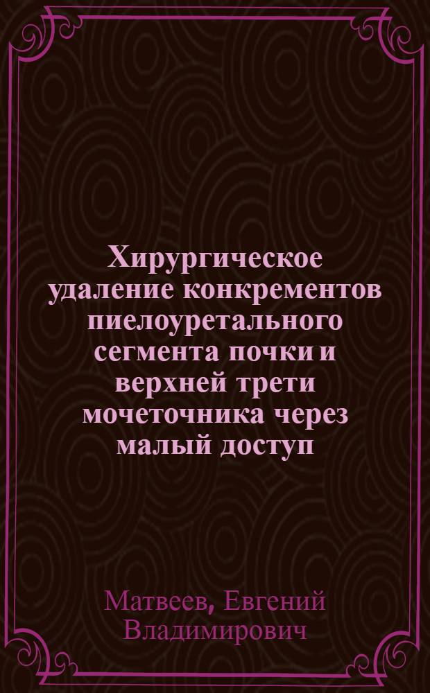 Хирургическое удаление конкрементов пиелоуретального сегмента почки и верхней трети мочеточника через малый доступ : автореф. дис. на соиск. учен. степ. канд. мед. наук : специальность 14.00.27 : специальность 14.00.40 <Урология>