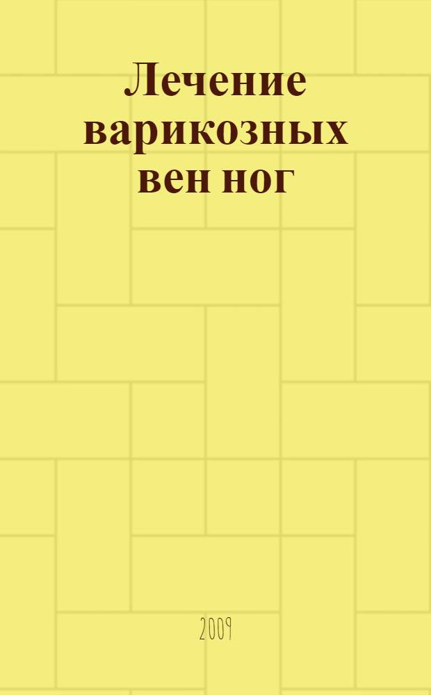 Лечение варикозных вен ног