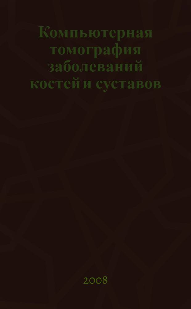 Компьютерная томография заболеваний костей и суставов