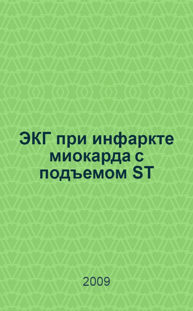 ЭКГ при инфаркте миокарда с подъемом ST : практическое руководство для врачей