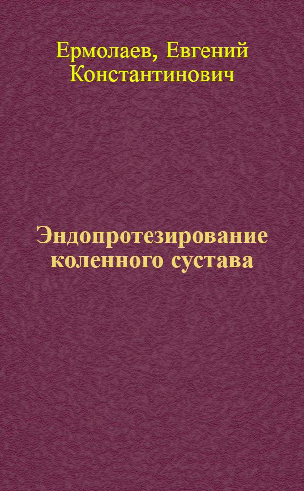 Эндопротезирование коленного сустава :(Эксперим.-клин. исслед.) : Автореф. дис. на соиск. учен. степ. к.м.н. : Спец. 14.00.22