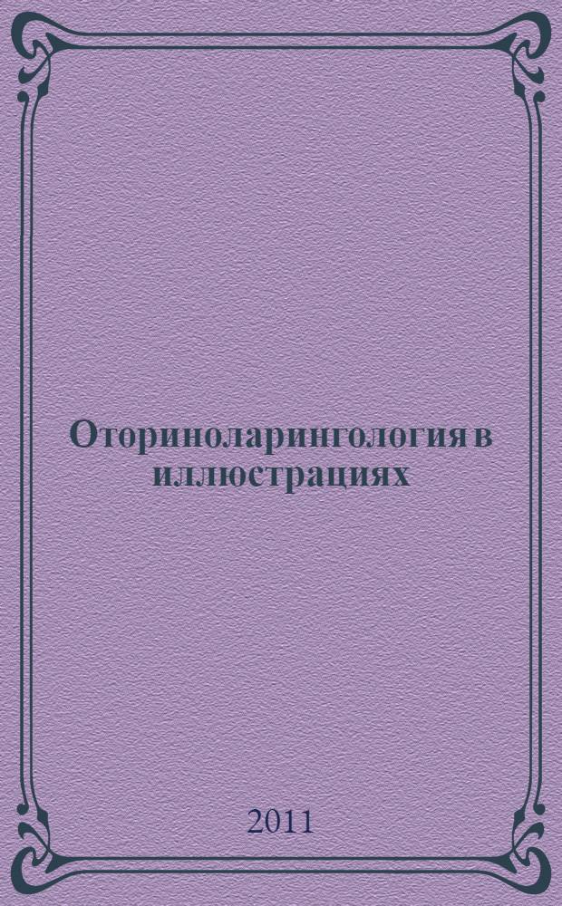 Оториноларингология в иллюстрациях : учебное пособие : для студентов, обучающихся по специальности 060109.51 "Сестринское дело" по дисциплине "Сестринское дело в оториноларингологии"