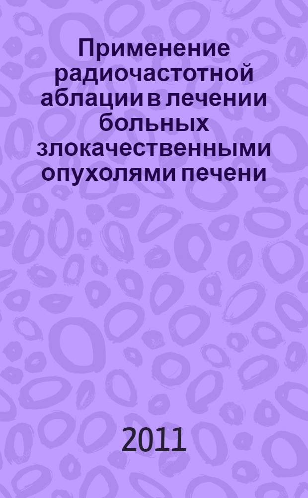 Применение радиочастотной аблации в лечении больных злокачественными опухолями печени
