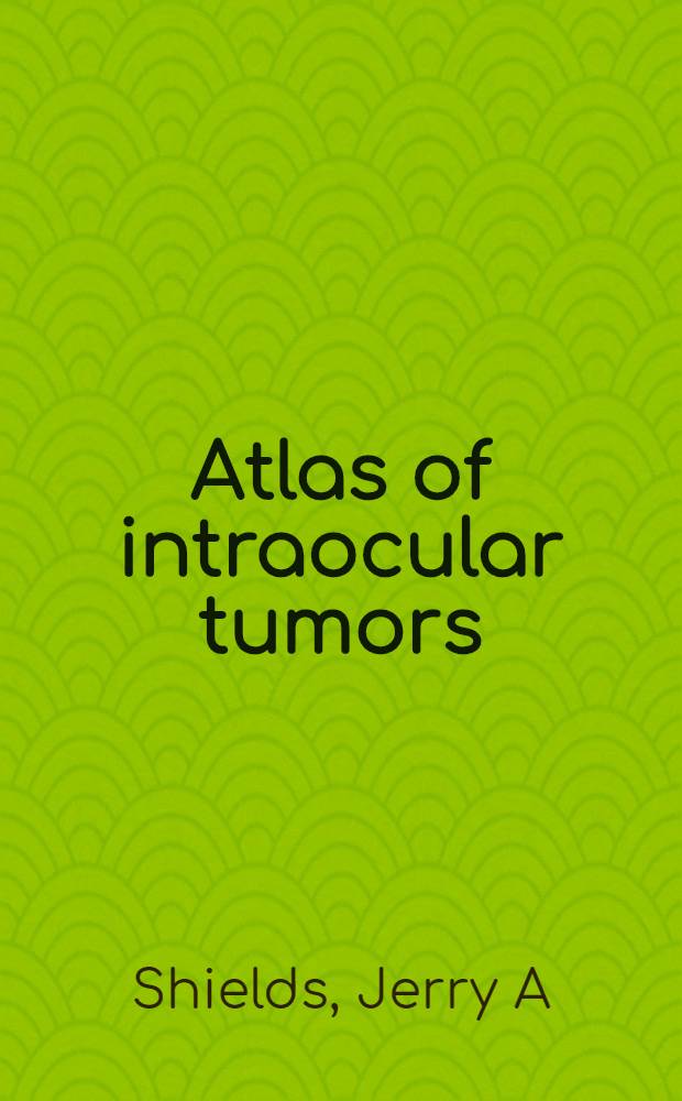 Atlas of intraocular tumors = Внутриглазные опухоли.