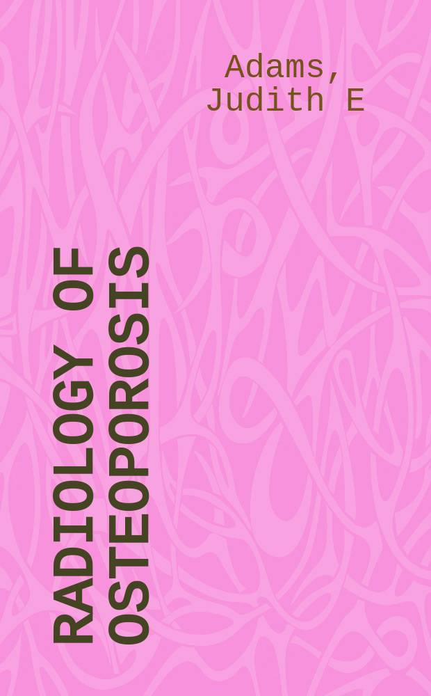 Radiology of osteoporosis = Радиология остеопороза.