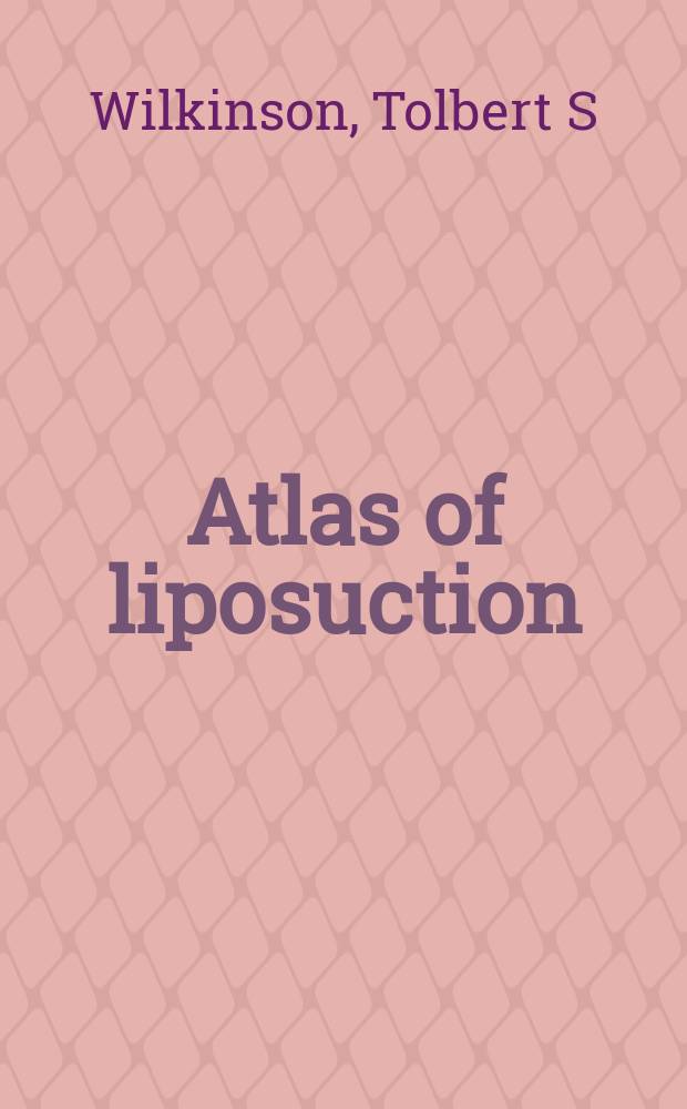 Atlas of liposuction = Атлас по липосакции.