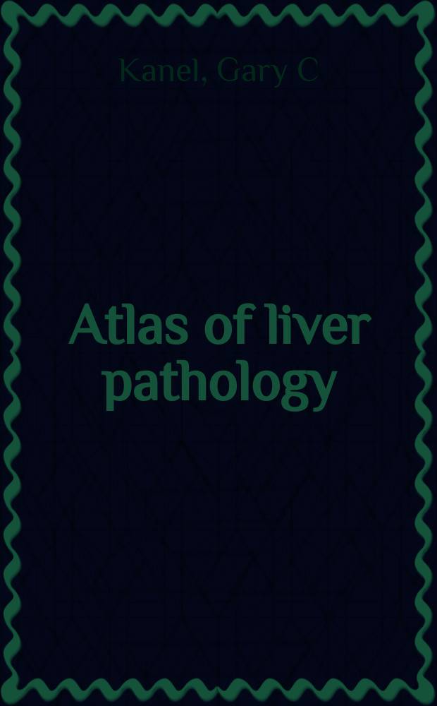 Atlas of liver pathology = Атлас болезней печени