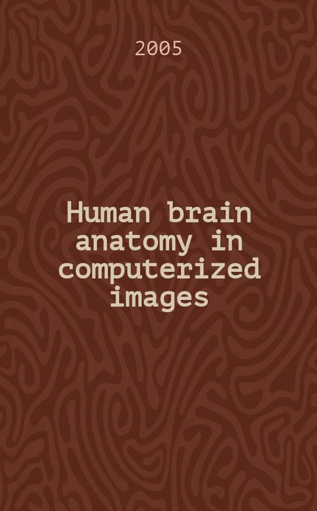 Human brain anatomy in computerized images : an atlas = Анатомия головного мозга в компьютерных изображениях.