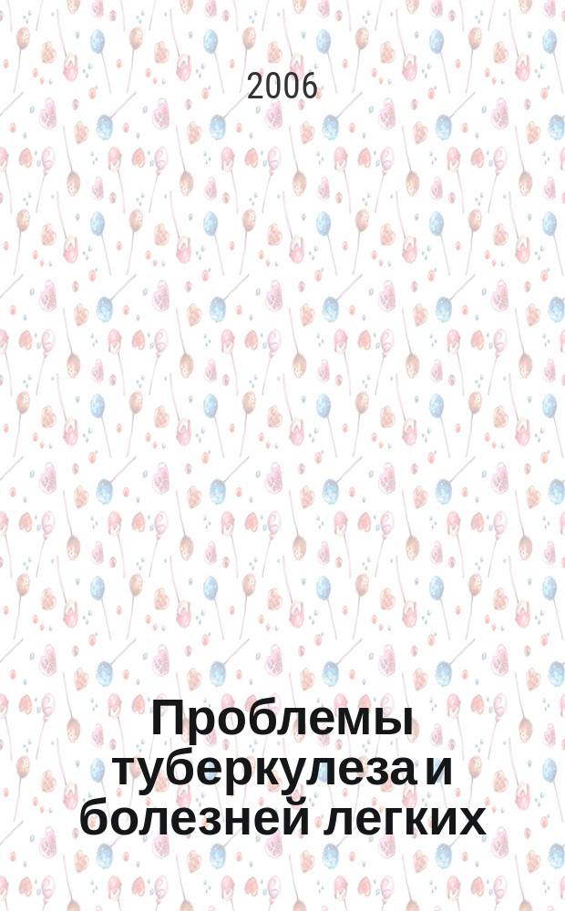Проблемы туберкулеза и болезней легких : Ежемес. науч.-практ. журн. 2006, № 2