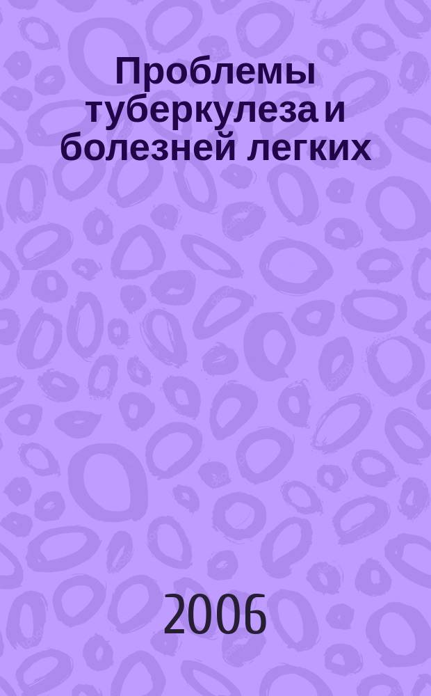 Проблемы туберкулеза и болезней легких : Ежемес. науч.-практ. журн. 2006, № 11