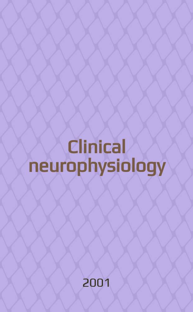 Clinical neurophysiology : Off. j. of the Intern. federation of clinical neurophysiology. Vol.112, №6