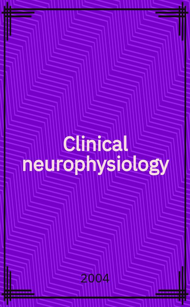 Clinical neurophysiology : Off. j. of the Intern. federation of clinical neurophysiology. Vol.115, №6