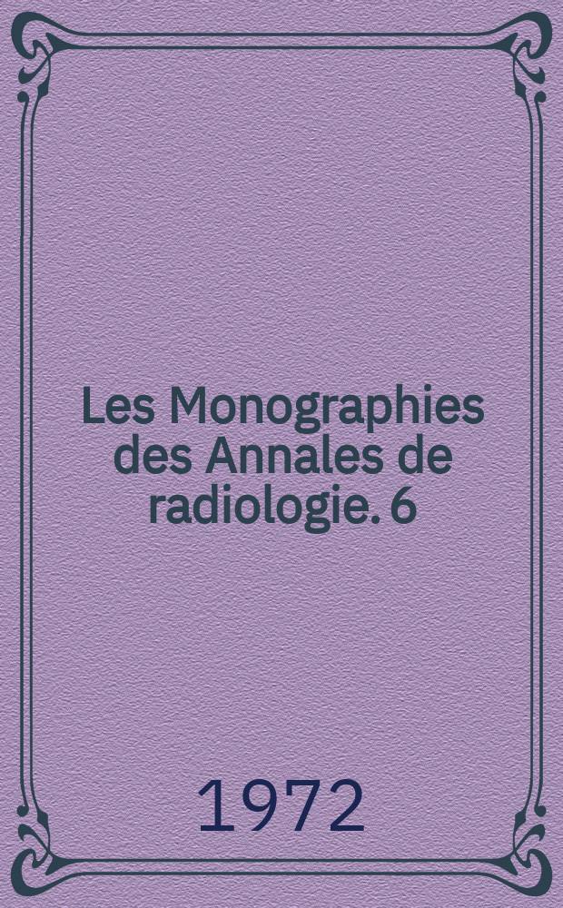 Les Monographies des Annales de radiologie. 6 : Techniques de télé cobalthérapie radicale