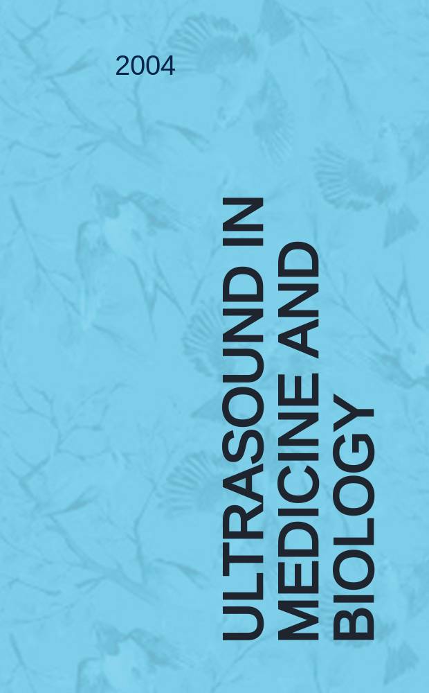 Ultrasound in medicine and biology : Offic. journal of the World federation for ultrasound in medicine and biology. Vol.30, №5