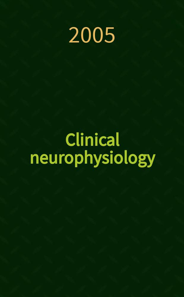 Clinical neurophysiology : Off. j. of the Intern. federation of clinical neurophysiology. Vol. 116, № 9
