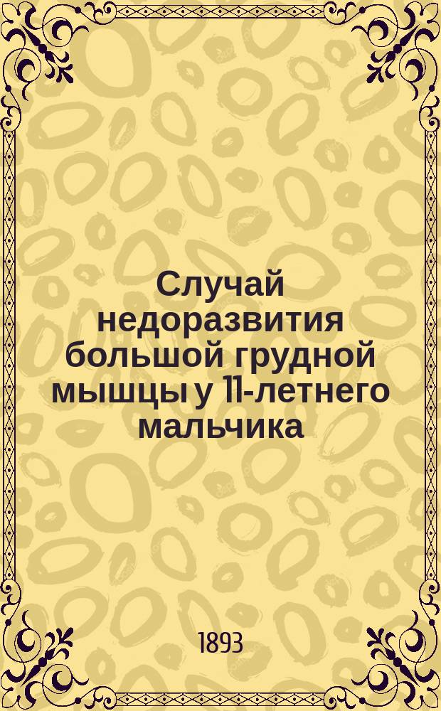 Случай недоразвития большой грудной мышцы у 11-летнего мальчика