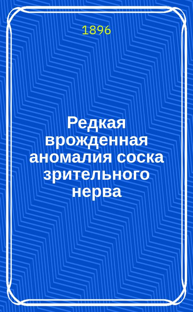Редкая врожденная аномалия соска зрительного нерва