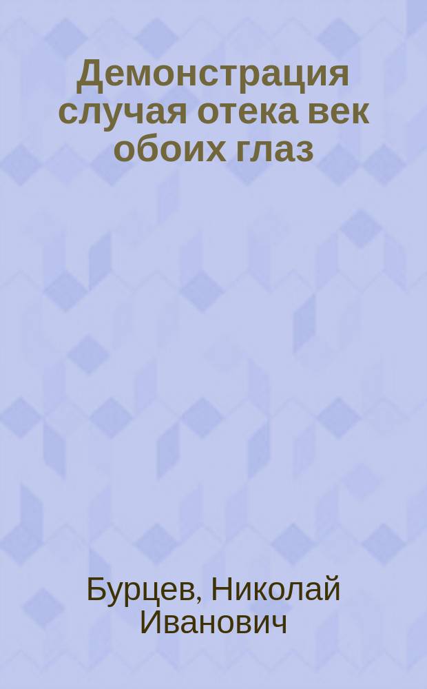 Демонстрация случая отека век обоих глаз : (Подозрительного происхождения) : Прил. к протоколу 2-го заседания