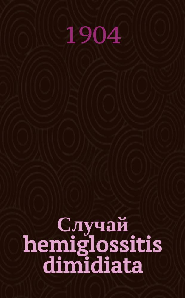 Случай hemiglossitis dimidiata