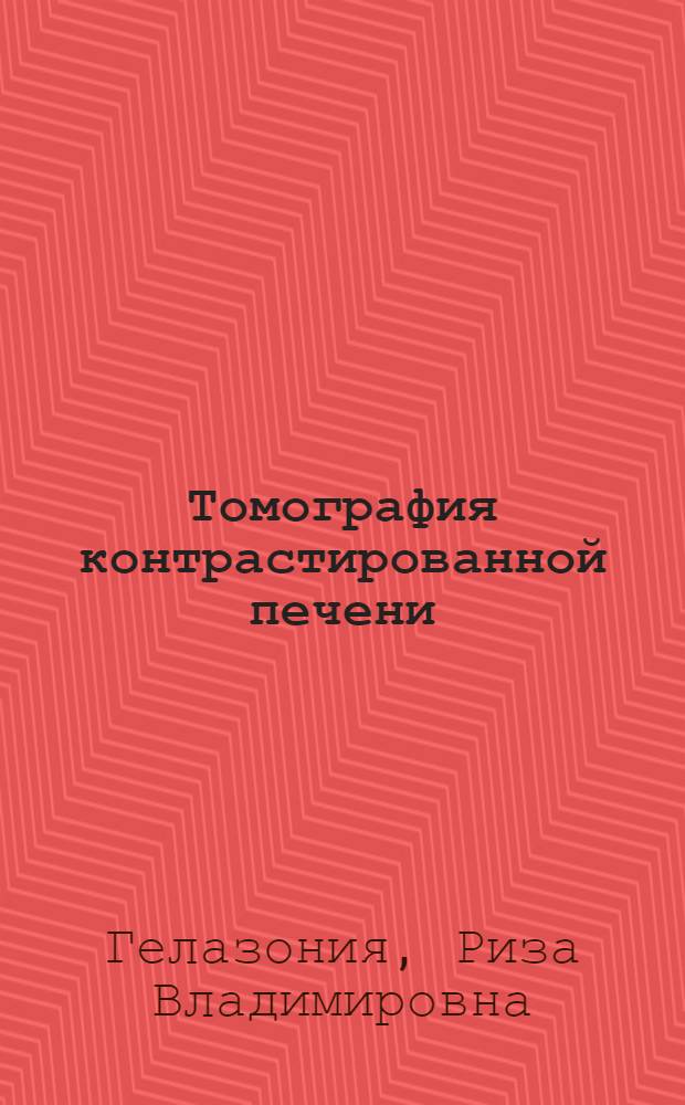 Томография контрастированной печени : Автореф. дис. на соиск. учен. степ. канд. мед. наук : (14.00.27)
