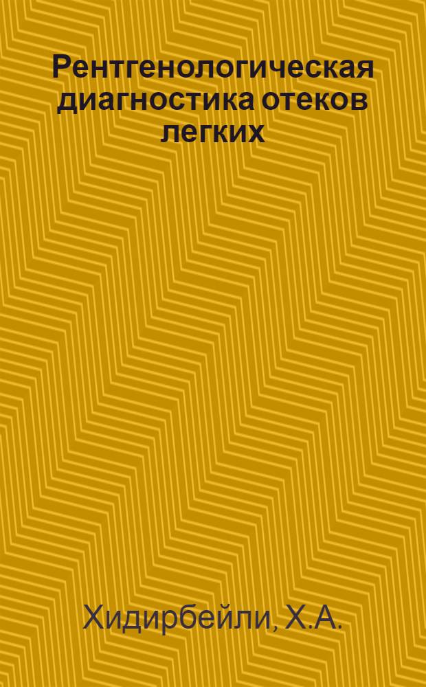 Рентгенологическая диагностика отеков легких : Автореф. дис. на соиск. учен. степени д-ра мед. наук