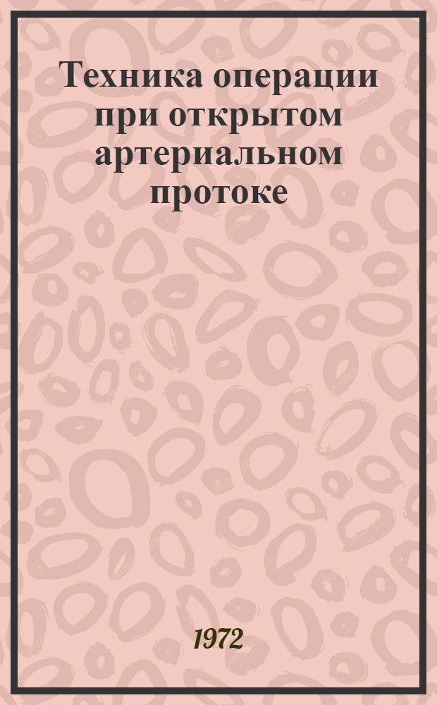 Техника операции при открытом артериальном протоке