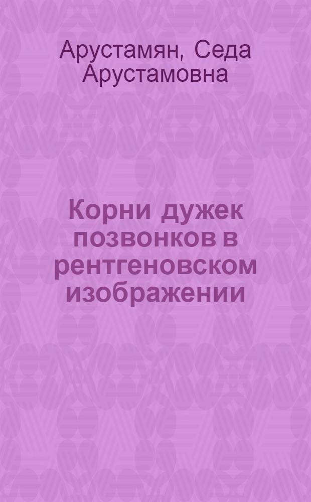 Корни дужек позвонков в рентгеновском изображении