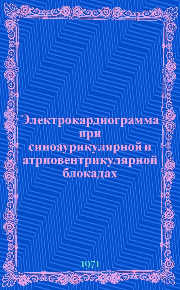 Электрокардиограмма при синоаурикулярной и атриовентрикулярной блокадах