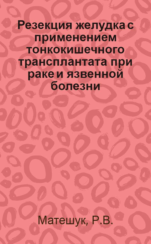 Резекция желудка с применением тонкокишечного трансплантата при раке и язвенной болезни : Автореферат дис. на соискание ученой степени кандидата медицинских наук