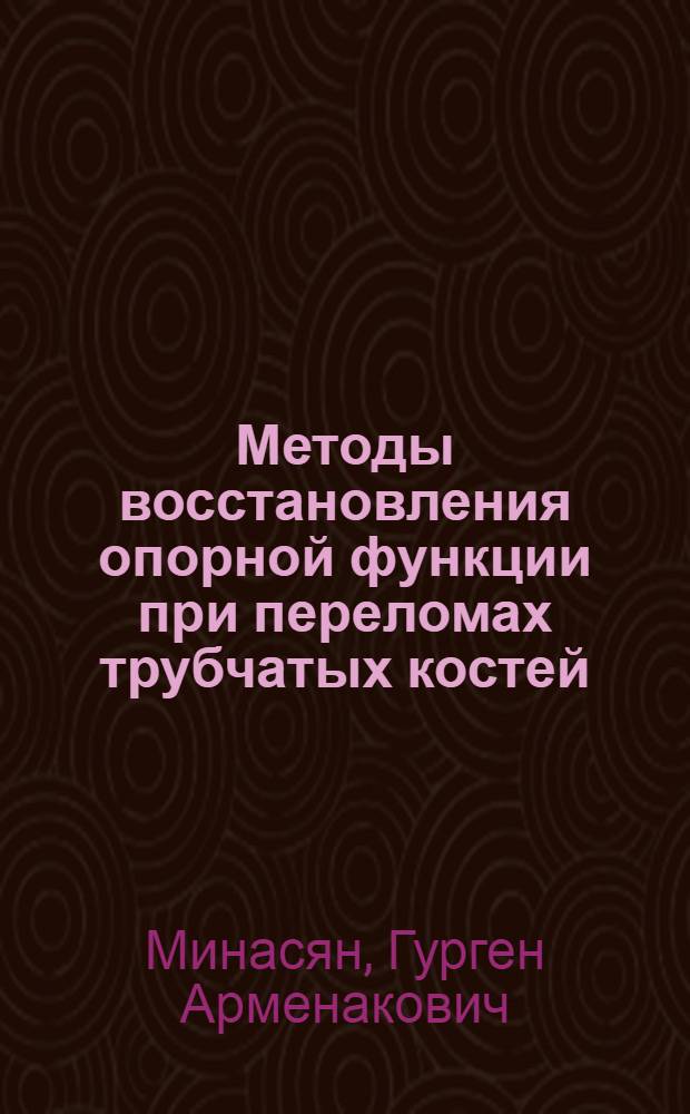 Методы восстановления опорной функции при переломах трубчатых костей