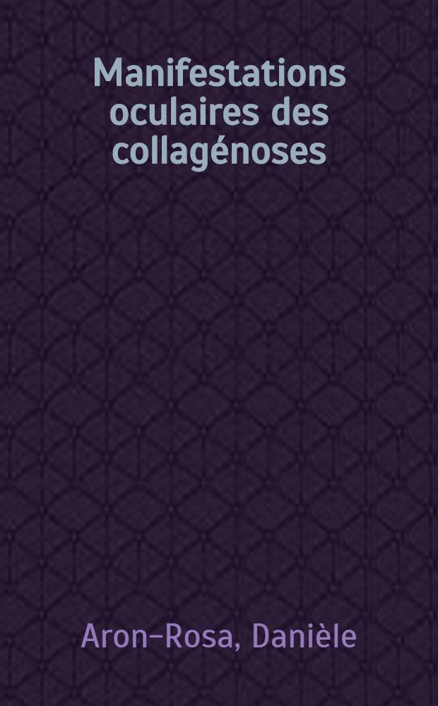 [Manifestations oculaires des collagénoses]