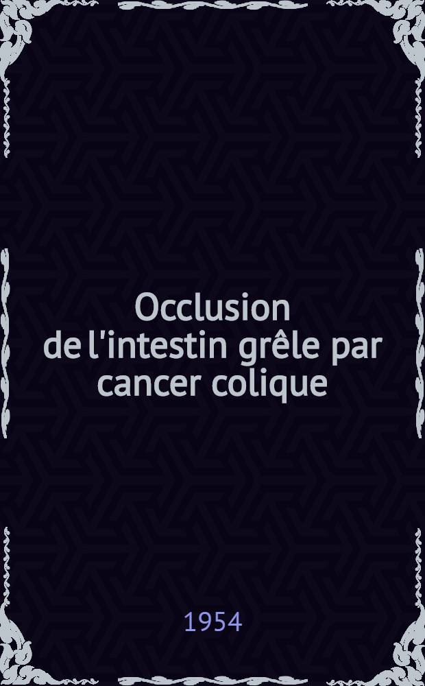 Occlusion de l'intestin grêle par cancer colique : Thèse ..