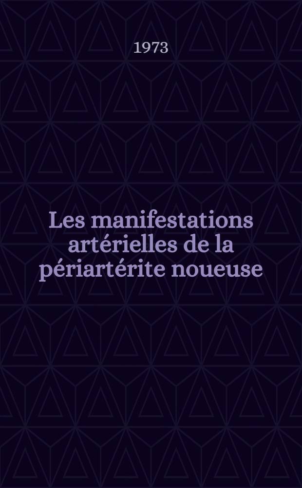 Les manifestations artérielles de la périartérite noueuse (anévrismes, thromboses, hématomes, infarctus) : À propos de deux observations cliniques et revue de la littérature : Thèse ..