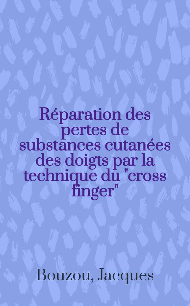 Réparation des pertes de substances cutanées des doigts par la technique du "cross finger" : Thèse pour le doctorat en méd