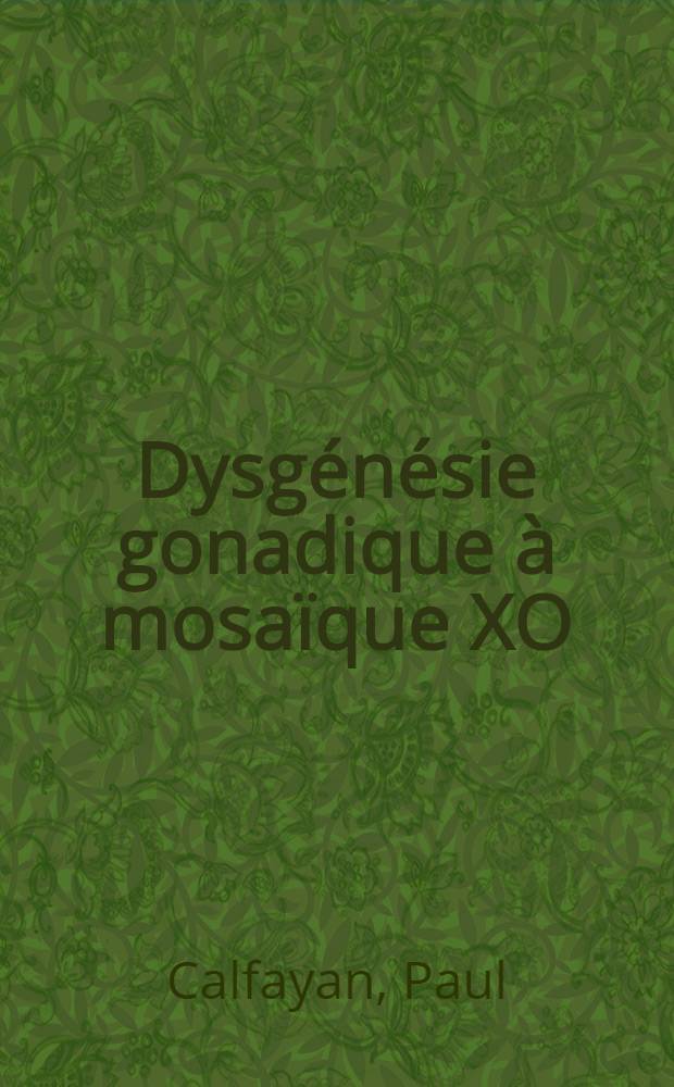 Dysgénésie gonadique à mosaïque XO/XY avec morphotype turnérien "a minima" et gonades indifférenciées : À propos d'une observation : Thèse ..