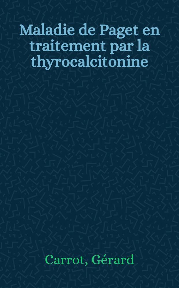 Maladie de Paget en traitement par la thyrocalcitonine : À propos de quinze observ. : Thèse