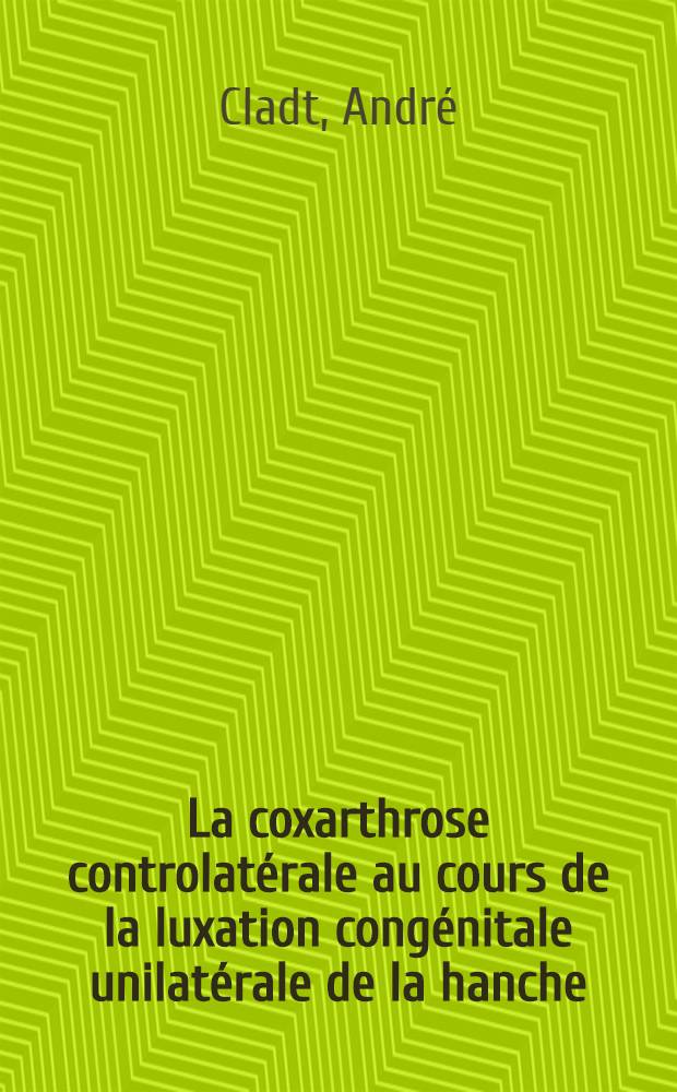 La coxarthrose controlatérale au cours de la luxation congénitale unilatérale de la hanche : Son traitement par le raccourcissement du fémur non luxé : Thèse ..