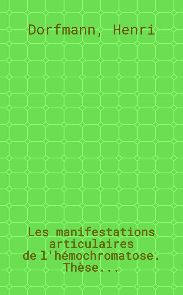 Les manifestations articulaires de l'hémochromatose. Thèse .. : À propos de 32 observations de la Clinique rhumatologique de l'Hôpital Lariboisière, service du prof. de Seze, et de 54 observations revues dans le cadre d'une enquête prospective