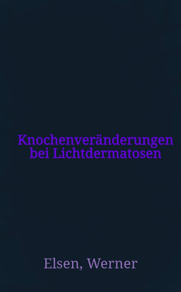 Knochenveränderungen bei Lichtdermatosen : Inaug.-Diss. ... der ... Med. Fak. der ... Univ. zu Bonn