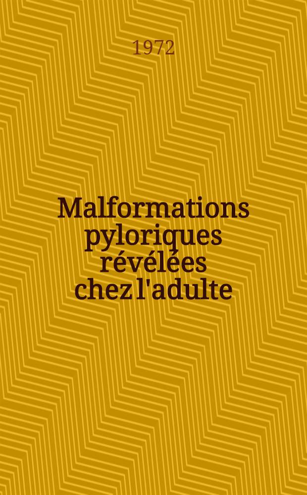 Malformations pyloriques révélées chez l'adulte : Thèse ..