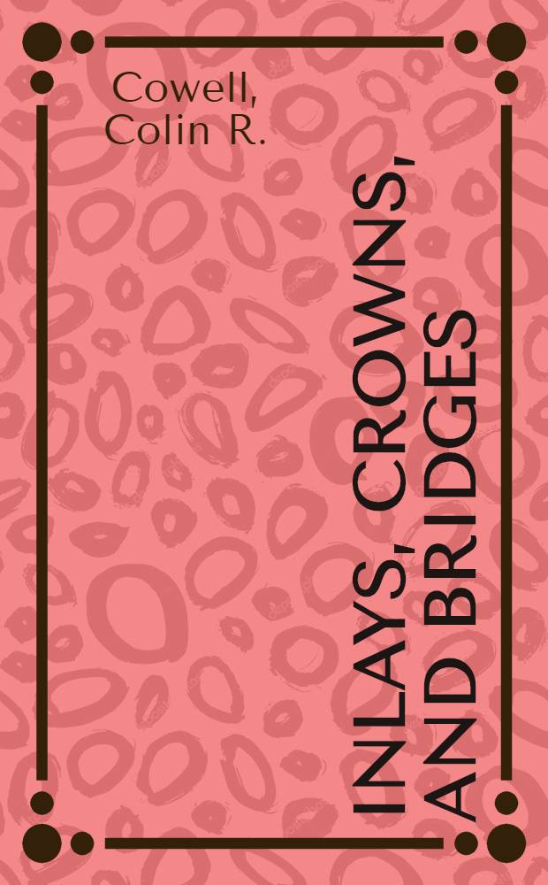 Inlays, crowns, and bridges : A clinical handbook