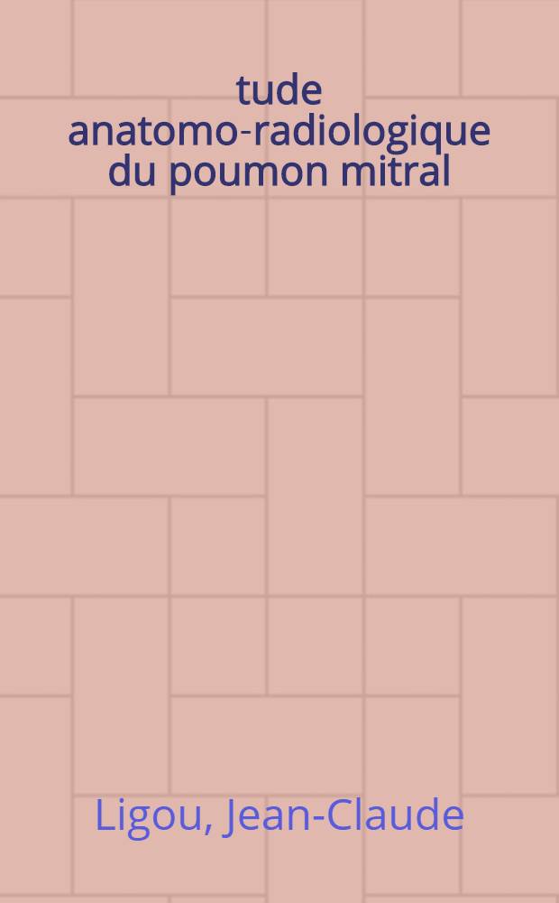 Étude anatomo-radiologique du poumon mitral : Thèse pour de doctorat en méd