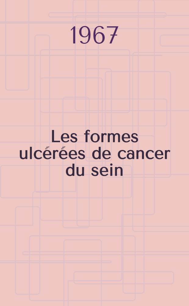 Les formes ulcérées de cancer du sein : (Étude de 55 observations) : Thèse ..