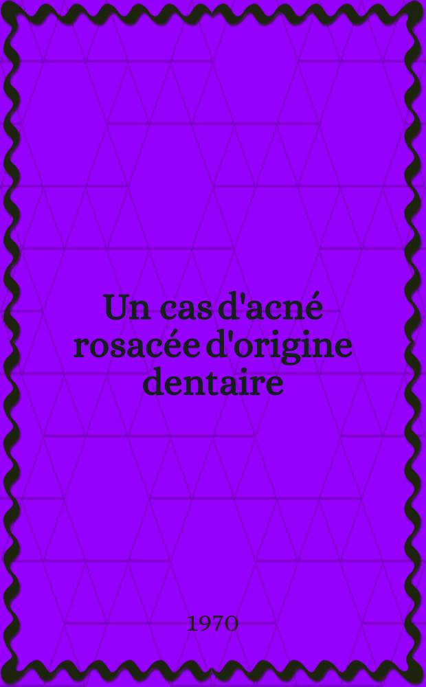 Un cas d'acné rosacée d'origine dentaire : Thèse ..